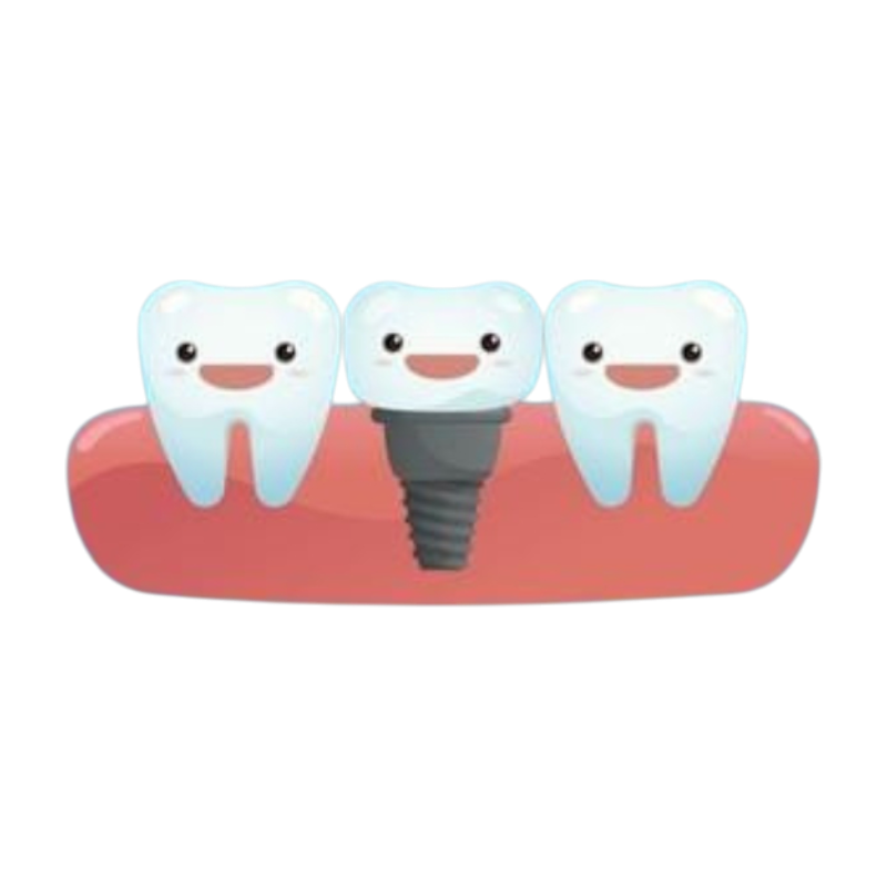 Dental implant